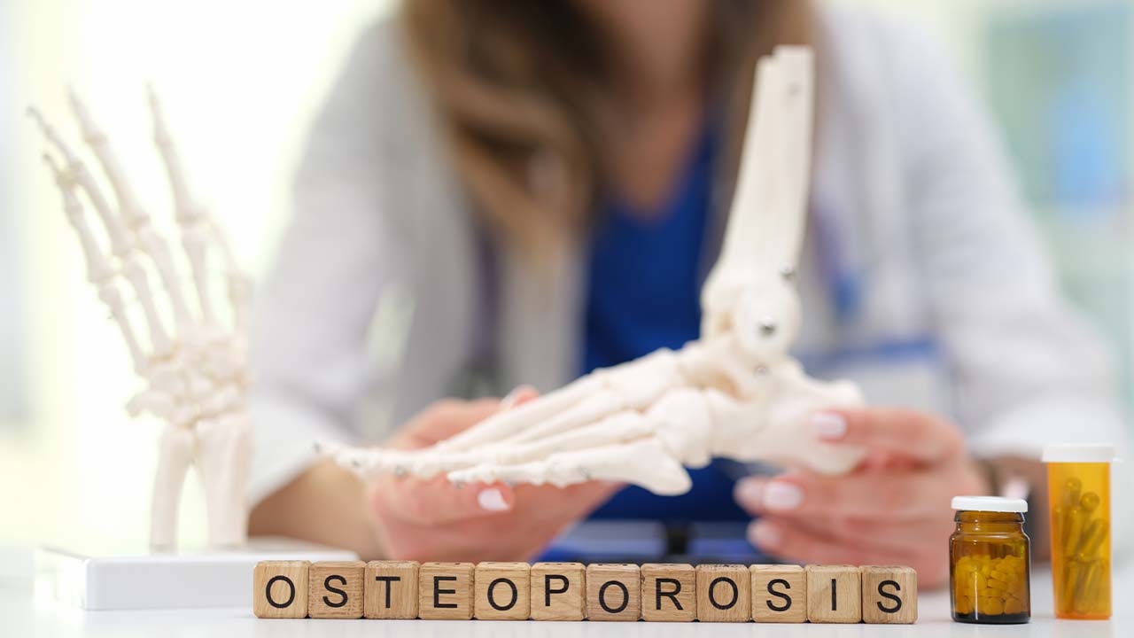 Trápi vás osteoporóza. Prečo vápnik z lekárne kosti nelieči?