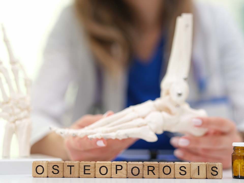 Trápi vás osteoporóza. Prečo vápnik z lekárne kosti nelieči?