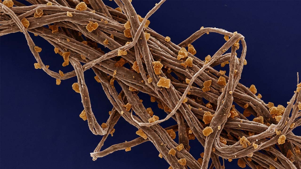 Ako zistím, že sa mi kolagén netvorí správne? Príznaky, že vaša tvorba kolagénu zlyháva 5 Detailný pohľad na poškodené kolagénové vlákna pod vplyvom glykácie