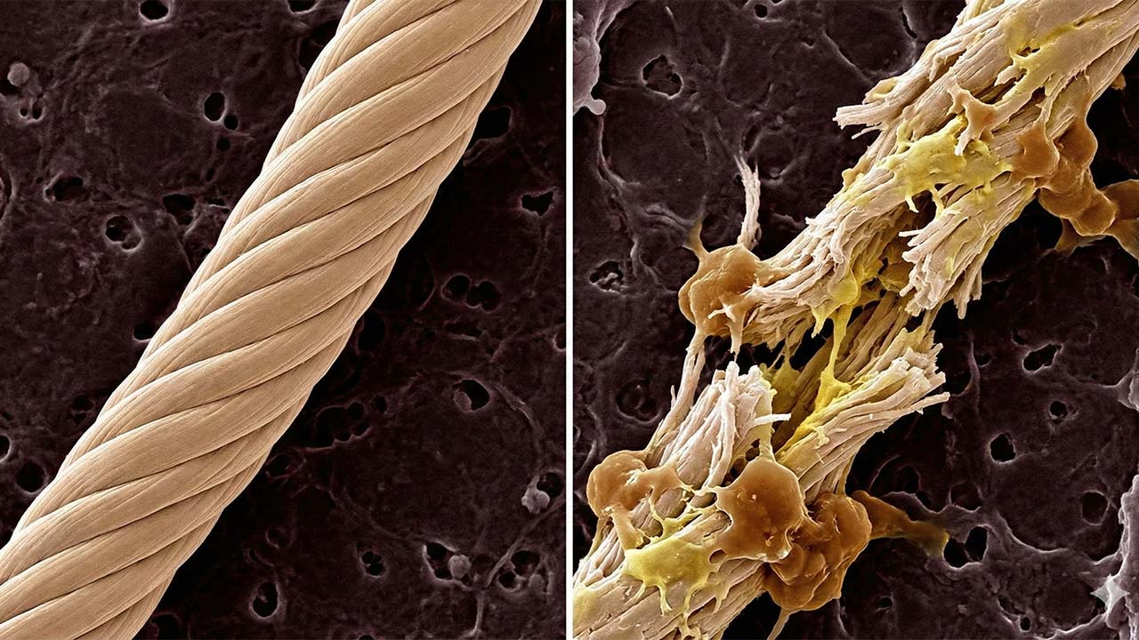 Ako nedostatok spánku ničí kolagén? (Viac než si myslíte) 4 Schéma poškodeného kolagénového vlákna v porovnaní so zdravým